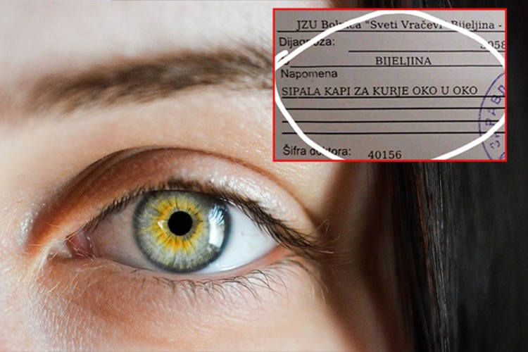 Bijeljina: Oporavlja se žena koja je u oko sipala kapi za kurje oko