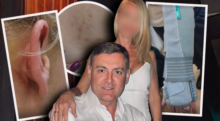 Tužilaštvo traži pritvor: Ovo je spisak svih povreda koje je hirurg nanio ženi brutalnim prebijanjem