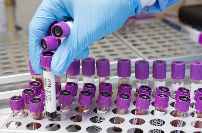 Korona virus potvrđen kod još 112 osoba u Srpskoj, preminulo 17 oboljelih