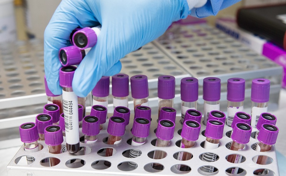 U RS 162 nova slučaja korone, šestoro preminulo