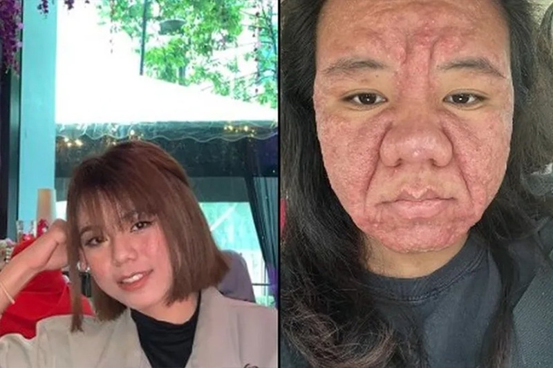 Trudnoća mladu djevojku pretvorila u staricu: Izgledala kao druga osoba (VIDEO)