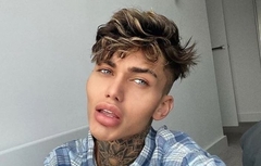 Potrošio 35 hiljada evra da bi izgledao kao INSTAGRAM filter