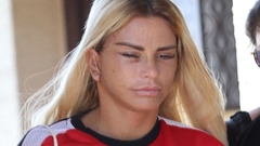 Starletu optužio bivši muž da plastičnim operacijama plaši djecu