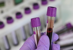 Potvrđena 122 nova slučaja korone u RS, preminulo pet osoba