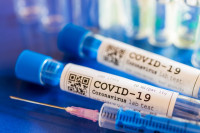 Na korona virus u Srpskoj pozitivne još 22 osobe