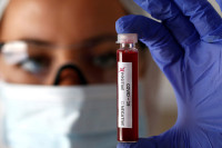 Na korona virus u Republici Srpskoj pozitivno još 12 osoba