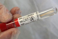 Na virus korona pozitivne još 32 osobe, najviše iz Banjaluke