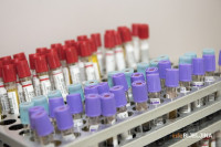 Potvrđena 103 nova slučaja zaraze virusom korona