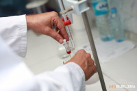 Cijena PCR testa u Hrvatskoj duplo niža