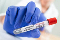 U Srpskoj 109 novih slučajeva virusa korona, ukupno 5.020; Oporavljeno 2.670