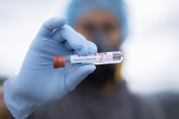 Virusom korona zaražena još 51 osoba u RS, pet iz Bijeljine