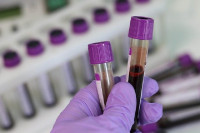 U Republici Srpskoj virus potvrđen kod još 39 osoba