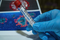 U Srpskoj zaraženo još 127 osoba, tri preminule