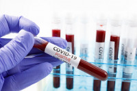 Korona virus potvrđen kod još 387 osoba u Srpskoj