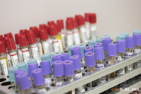 U Srpskoj 648 novozaraženih