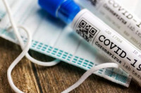 U Srpskoj 362 novooboljelih