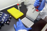 Počinje serološko testiranje stanovništva Srpske