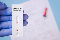 ZA 20 MINUTA DO REZULTATA Uskoro u prodaji kućni test na korona virus