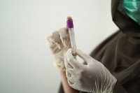 RADNO I TOKOM PRAZNIKA Komercijalno testiranje na VIRUS KORONA moguće 2. i 6. januara