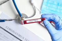 Za komercijalno testiranje u Srpskoj potrebno se naručiti pet do šest dana ranije