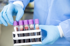 Na korona virus pozitivne još 63 osobe u Srpskoj, preminulo sedam zaraženih