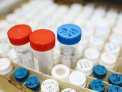 U Srpskoj zaražene 23 osobe; Preminulo sedmoro