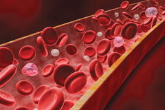 Sve više ljudi u ruci ima dodatnu arteriju, evolucija se nastavlja
