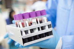  Na korona virus u Srpskoj pozitivna jedna osoba, preminuo jedan pacijent