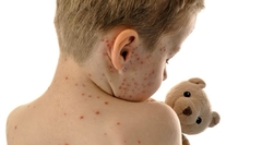 INZ: Poziv vrtićima i roditeljima čija djeca nisu vakcinisana na području cijele BiH