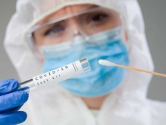 U Srpskoj 216 zaraženih; Preminulo 15 osoba