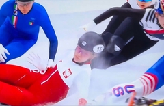 Klizaljka joj rasjekla lice na ZOI, pokazala kako sada izgleda (FOTO)