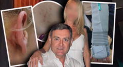 Tužilaštvo traži pritvor: Ovo je spisak svih povreda koje je hirurg nanio ženi brutalnim prebijanjem