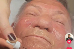 Pjevač iz Bijeljine riješio da se podmladi, pohvalio se na TikToku (VIDEO)