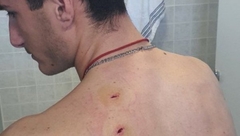 "Današnji napad na srpskog mladića posljedica Kurtijeve antisrpske histerije"