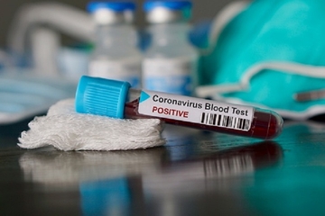 Na korona virus pozitivno još 29 osoba u Srpskoj, preminulo četvoro zaraženih
