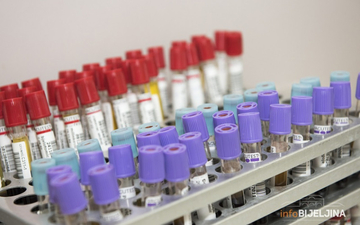 Zašto se rezultati testova na antitijela toliko razlikuju, od čega to zavisi?