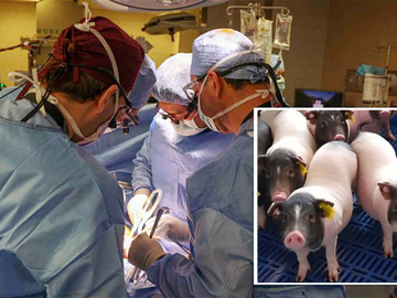 Svinjsko plućno krilo uspješno presađeno kod čovjeka