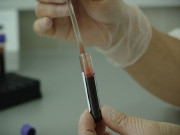 Epidemiološka situacija sve gora: U Srpskoj detektovan delta soj