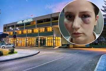 Pretučena radnica iz Jablanice uoči protesta: Očekujem veliki broj ljudi, teško se oporavljam