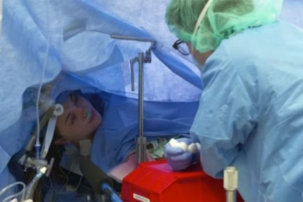 Bolnica prenosila operaciju mozga na Facebooku