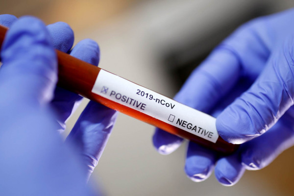 U BiH stiže 400 kilograma zaštitne opreme i hiljadu testova za virus korona