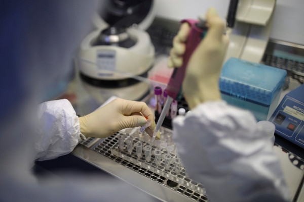 Dogovorena nabavka 25.000 testova na virus korona