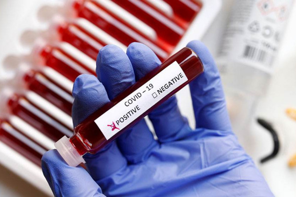 U Njemačkoj preminulo 732 ljudi