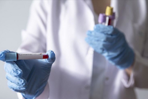 Četiri nova slučaja zaraze virusom korona u FBIH