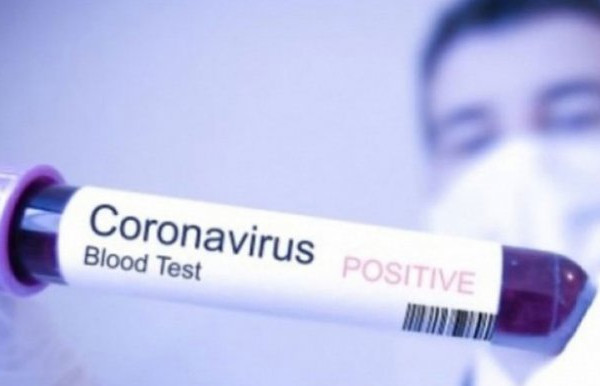 U SAD-u umrlo dijete staro šest sedmica; svijet se bliži milionu zaraženih