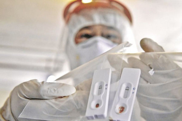 Tri nova slučaja u FBiH