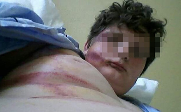 Upozorio ih je da ne sijeku stabla, a oni uzvratili batinama: Šumokradice pretukle maloljetnika kod Brčkog