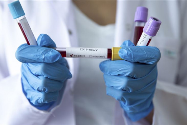 Cijena komercijalnog testa na korona virus 200 KM: Testiranje u Srpskoj jeftinije u odnosu na region?