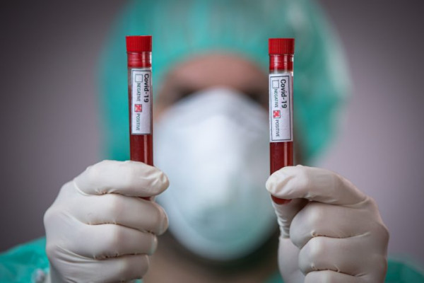 Virus korona potvrđen kod još 14 osoba u Republici Srpskoj