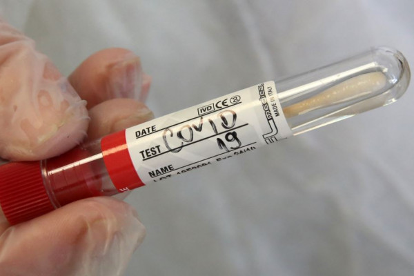 Na virus korona pozitivne još 32 osobe, najviše iz Banjaluke